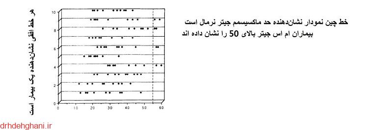 تفسیر تست نوار عصب و عضله برای تشخیص ام اس