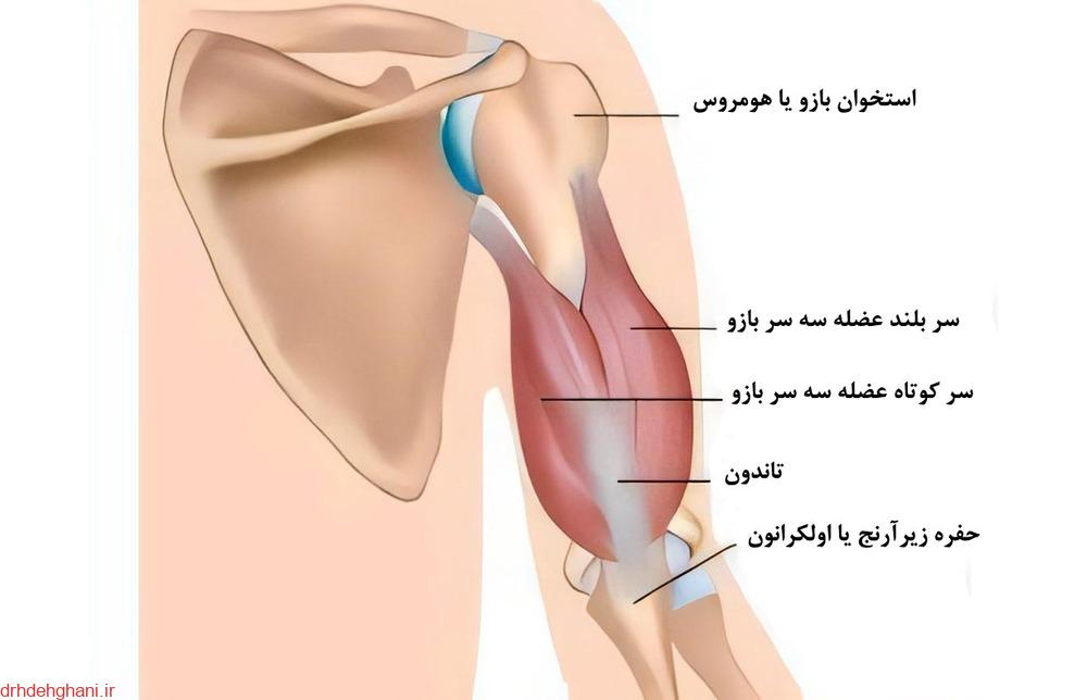 تاندونیت عضله پشت و جلوبازو